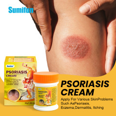 Sumifunクロスボーダー膏アマゾン白癬覇薬クリームPsoriasis Cream皮膚ケアクリームk 20124
