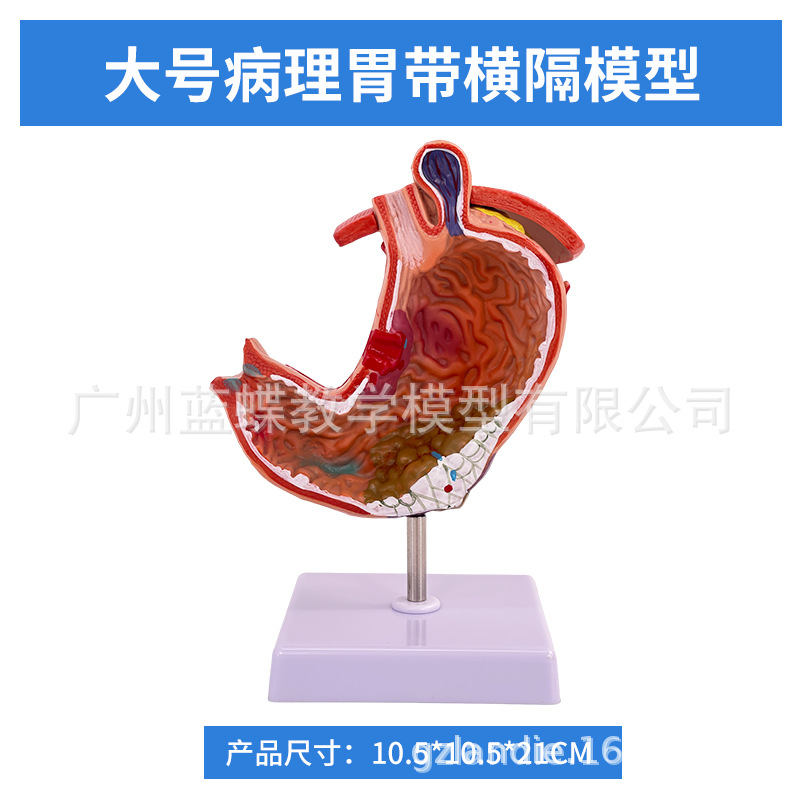 ������θģ������θ�봩�ײ�̬θģ��������θ��״�����������