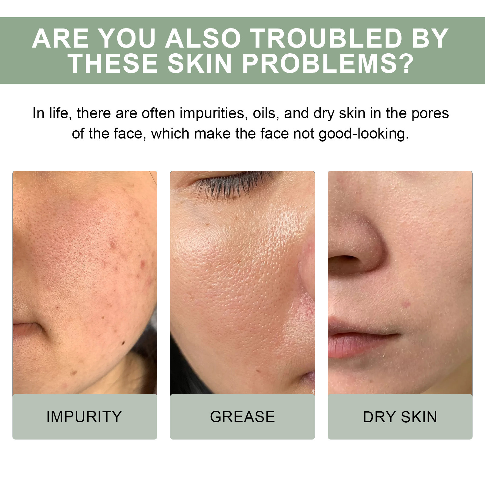 Το καθαριστικό καθαρισμού πόρων Hoygi φωτίζει την επιδερμίδα του προσώπου, καθαρίζει σε βάθος τα σημάδια ακμής, καθαρίζει, ενυδατώνει και ενυδατώνει_voghion.com