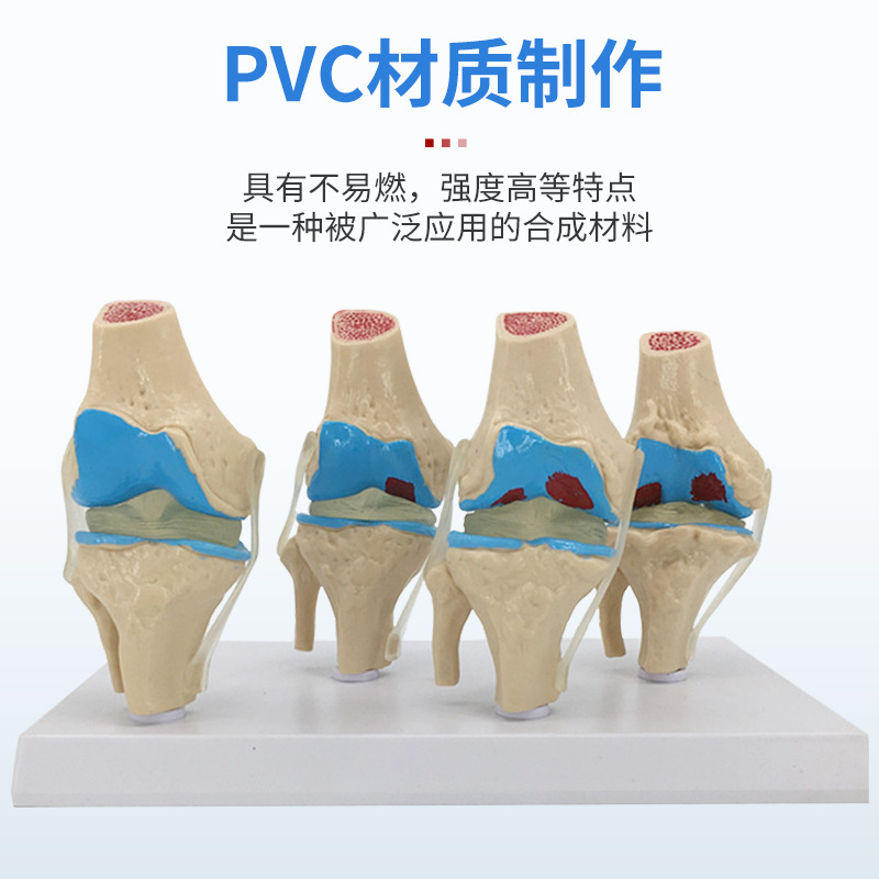 ��̬ ϥ�ؽ�ģ�� �Ľ׶β���ϥ�ؽ�ģ�� ���� ����ϥ�ؽ�ģ��