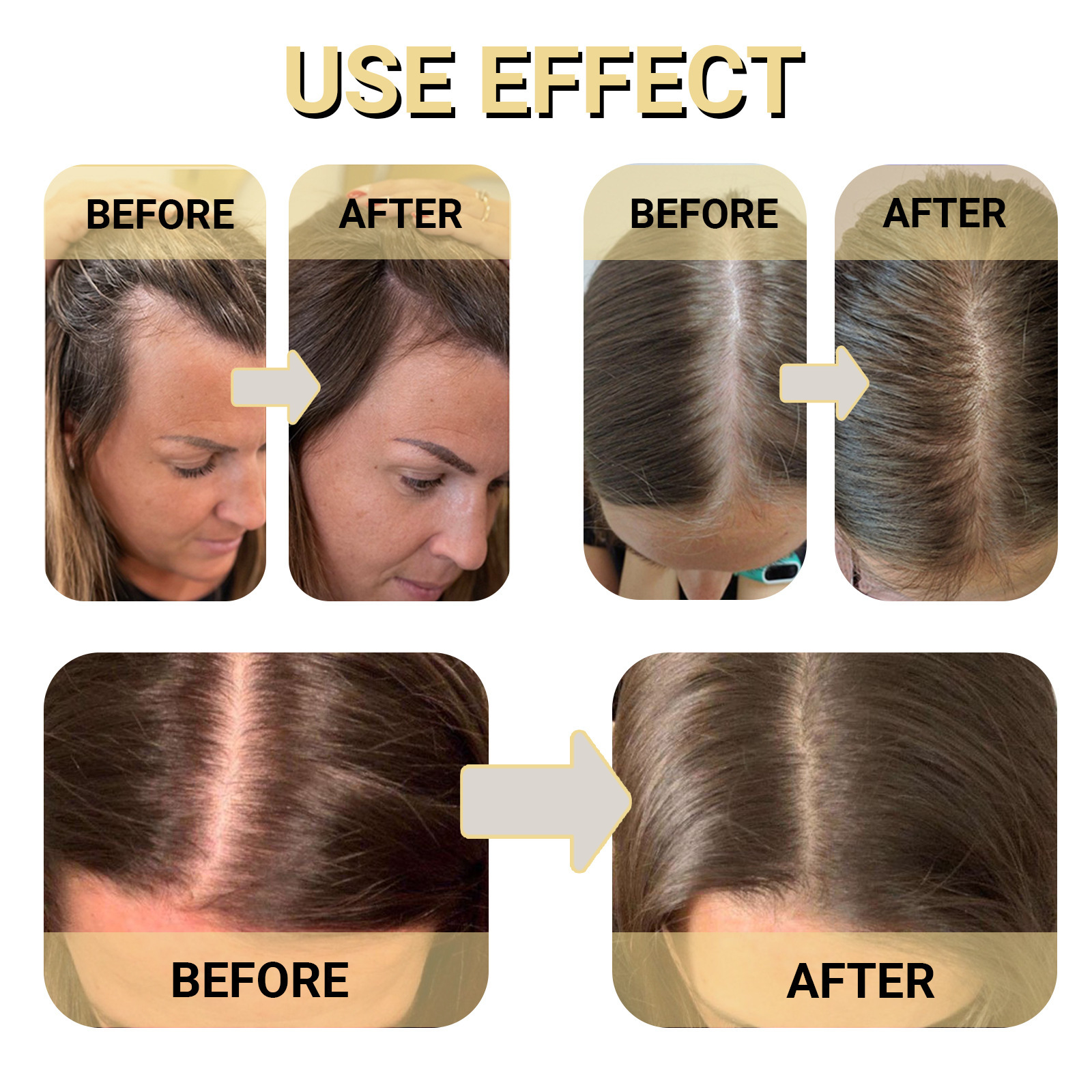 OUHOE Dense Hair Essential Oil Image 6