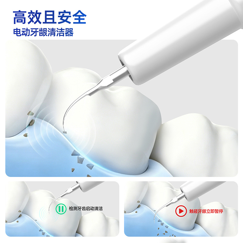 超声波洁牙器去除牙结石口腔清理牙齿污垢电动洗牙器便携家用跨境