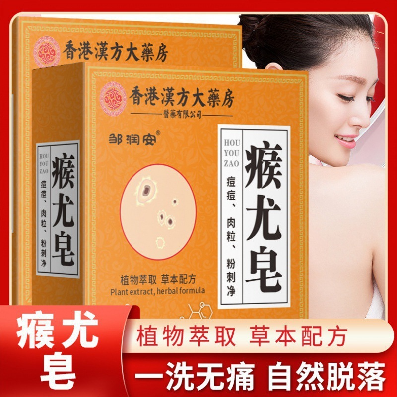 香港薬局の疣贅石鹸は全身に使用でき、痒みを和らげる石鹸、猿の小さな肉粒の洗浄手作り石鹸、卸売在庫あり|undefined