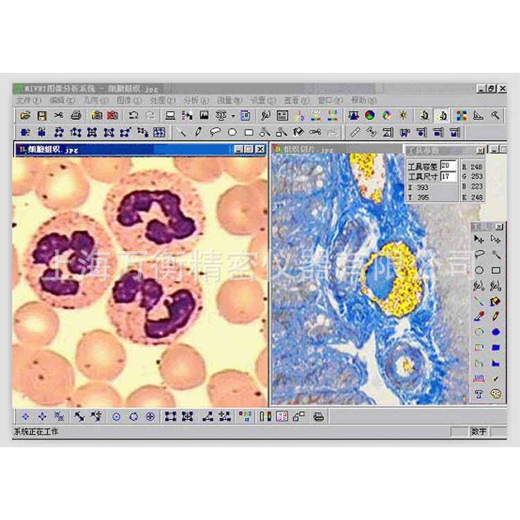 Microscopic Image Analysis Software Professional Metallographic Image Analysis Software MI3000
