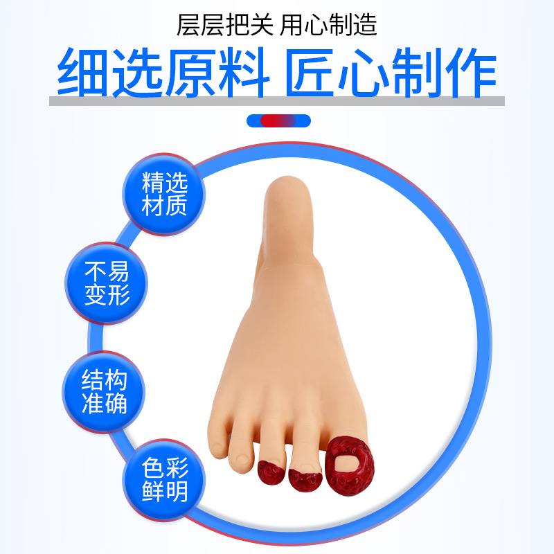 ��/���㻤��ģ�� ��/�򲡻����㲿����ģ���㲿�����仯��ģ��