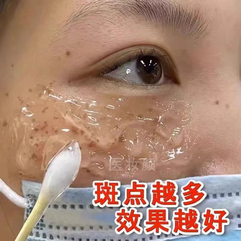 臭臭水は、鉛、水銀、肝斑、色素沈着、メラニンを分解し、肌を明るくします。臭臭水タヒルエッセンスウォーター|undefined