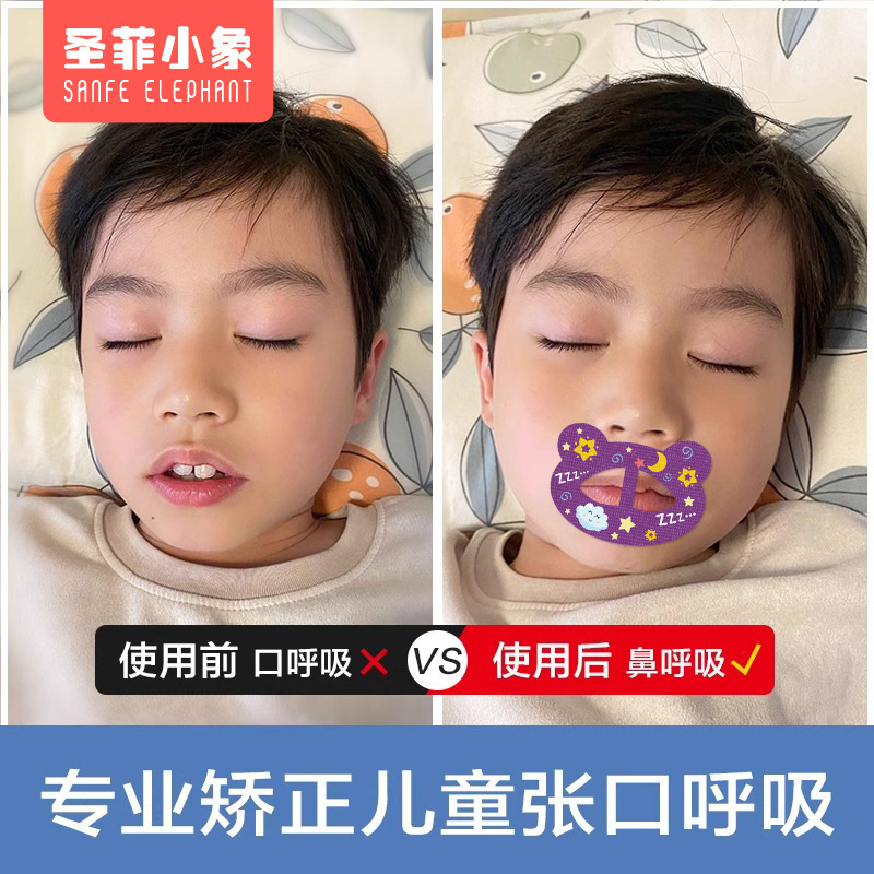口呼吸矯正は口を閉じて寝ます。口を開けない神器の口は口を閉じます。|undefined
