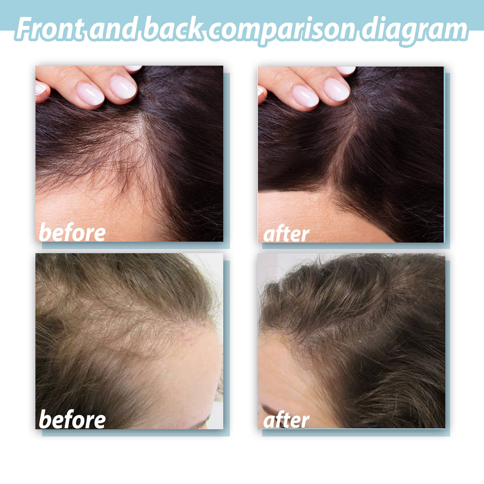 Crema Herbal Scrub Jaysuing para el cuidado del cabello, champú y champú para la prevención del crecimiento del cuero cabelludo_voghion.com