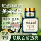 Live Hot Selling Qianfei Zhenbai Freckle Mask Removing Yellow and Brightening Skin Color Fading Spotty Moisturizing Wash-Free Mask