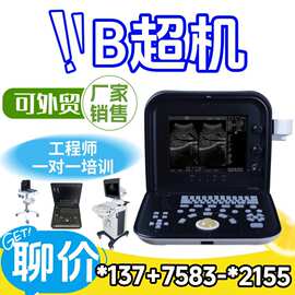 彩超机B超机在哪买 便携式彩超 彩色彩色检查仪生产厂家
