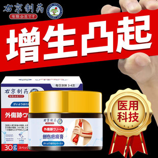 �Ҿ���ș�̺۸�ȥ����ϰ�˪��ƽ���������o���o��ȥӡ�̌���Һ