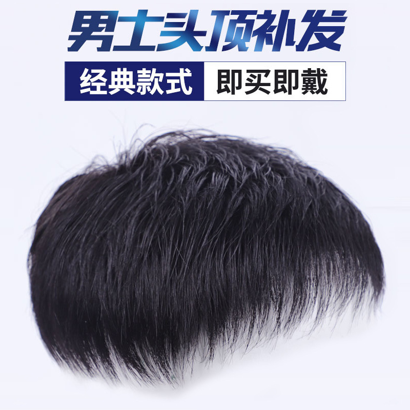 许昌厂家男士补发块寸头短发地中海秃顶真发遮白发透气假发补发顶|undefined