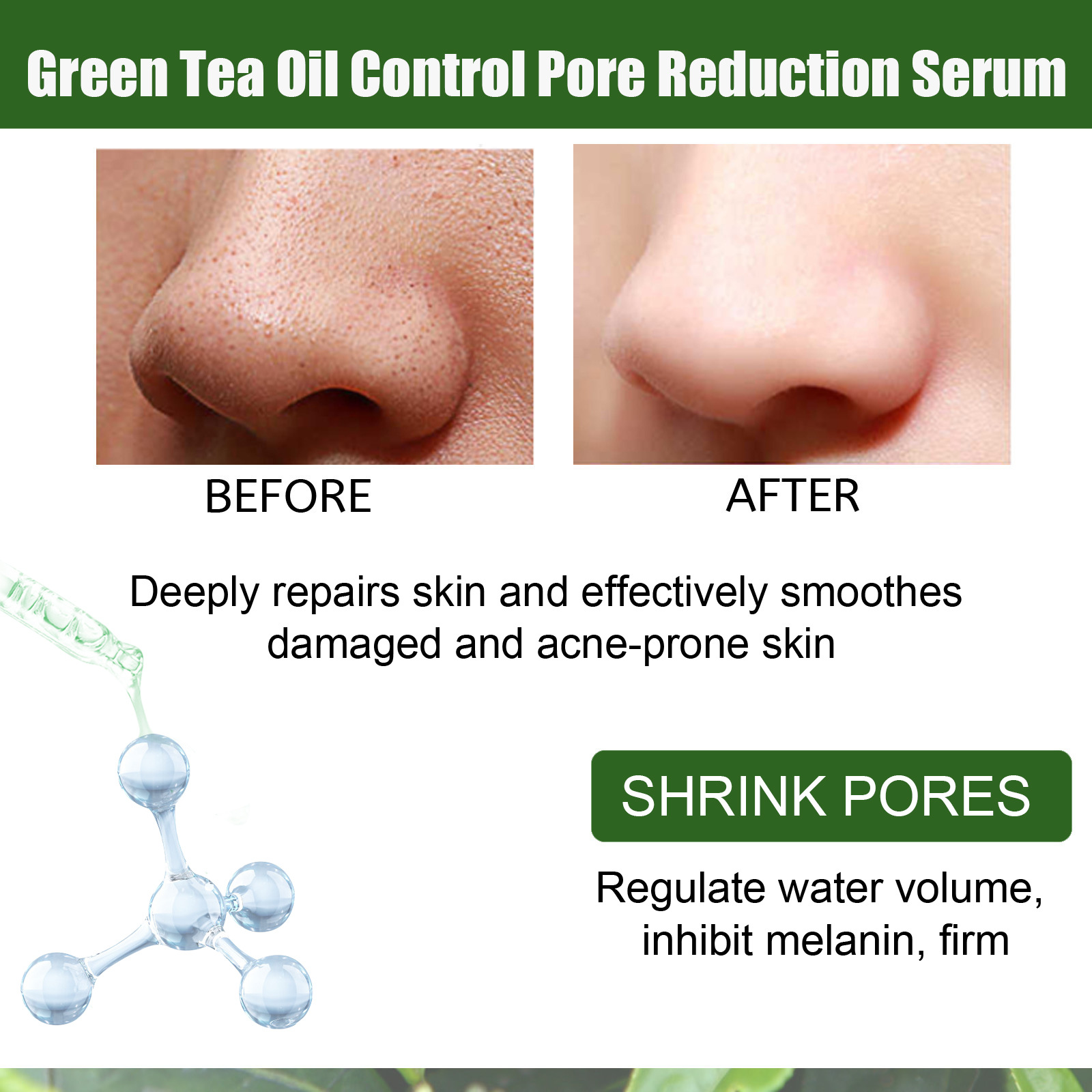 EELHOE Green Tea Pore Shrinking essence Solution Moisturizes, moisturizes, gently shrinks, refines pores, revitalizes_voghion.com