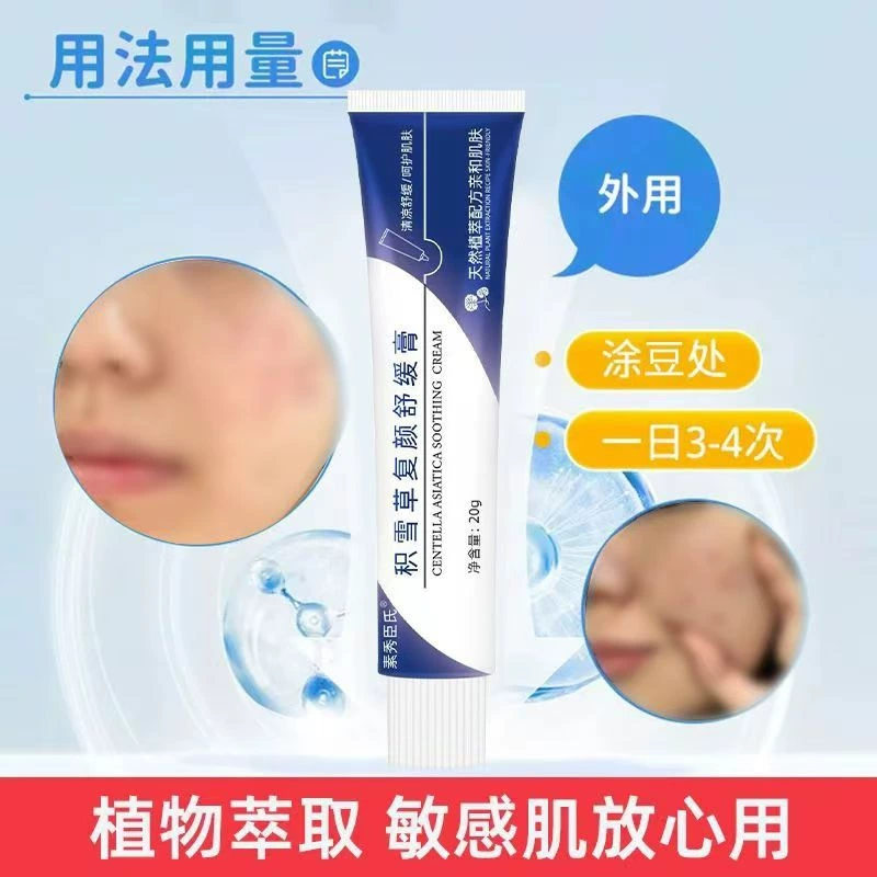 [Су Сючунь] Крем-мазь с центеллой азиатской удаляет следы прыщей и уменьшает ямки от прыщей, 20 г/тюбик