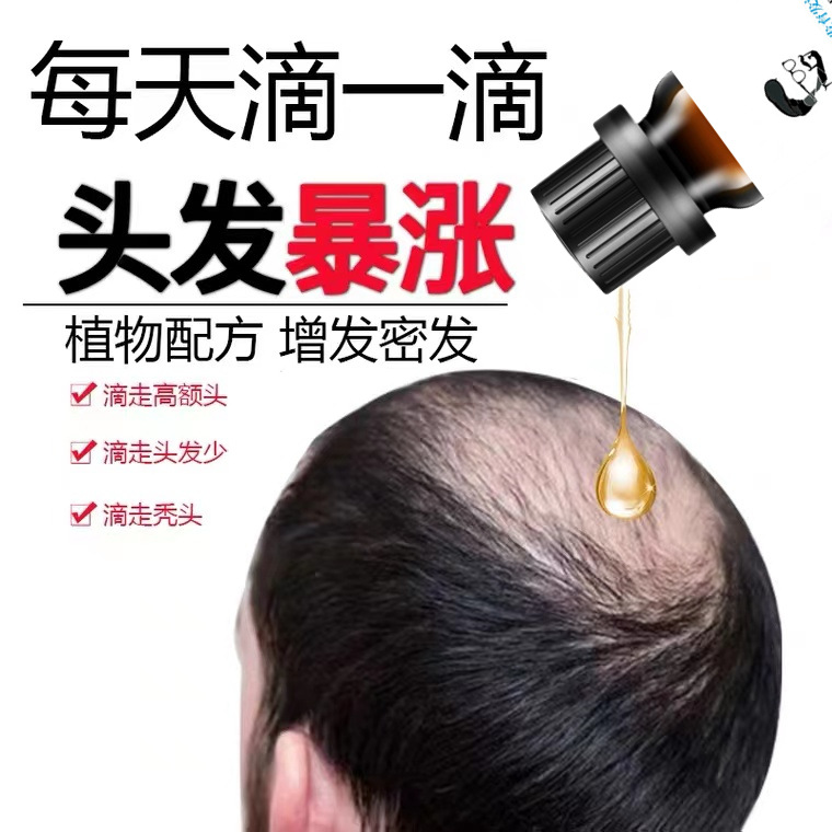 跨境曖昧小鳥育發液防脫生髮液增發密發劑髮際線增長液固發生長液