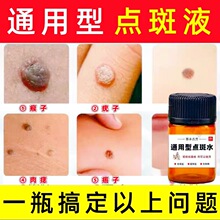 点斑水无痕水祛斑斑雀斑药水点斑0激素提取液祛斑液排色液通用型