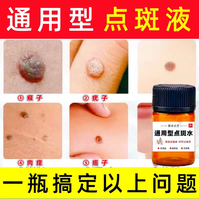 点斑水无痕水祛斑斑雀斑药水点斑0激素提取液祛斑液排色液通用型