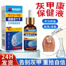 ��ָ��șˮ�ͼ׸��ָ�׿羳ܛÓ�׸��־����ָ��ș��Ҽ���