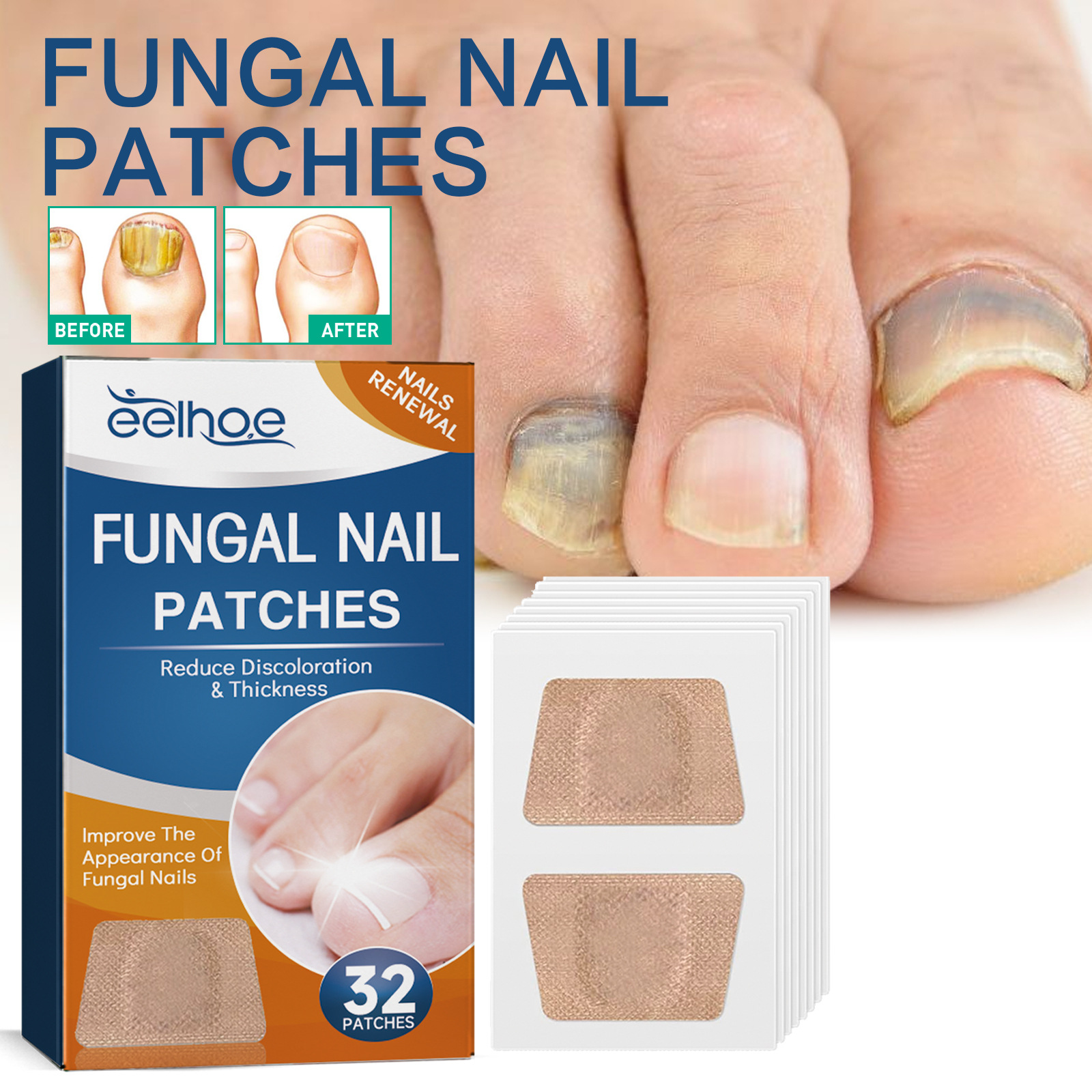 EELHOE Nail Repair Patch—For Ingrown Toenails, Thickened Nails, and Brightening Nail Grooves—Care for Onychomycosis and Softening of Toenails