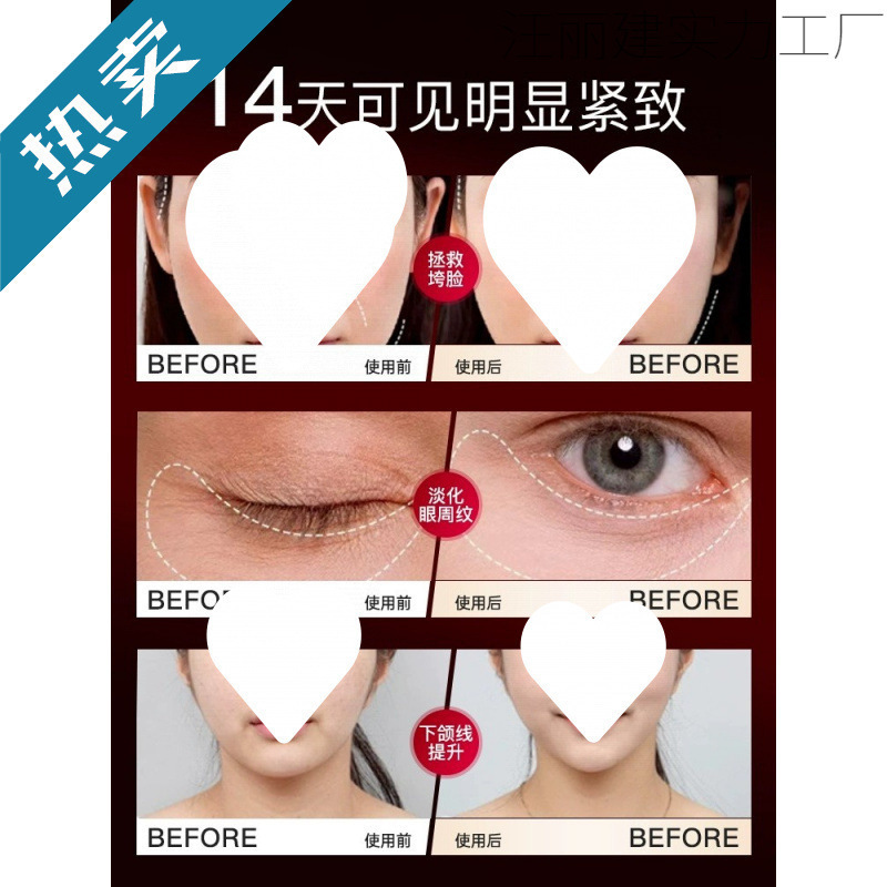 大熨斗美容仪器家用脸部提拉紧致按摩胶原炮射平面部精华频导入仪|undefined