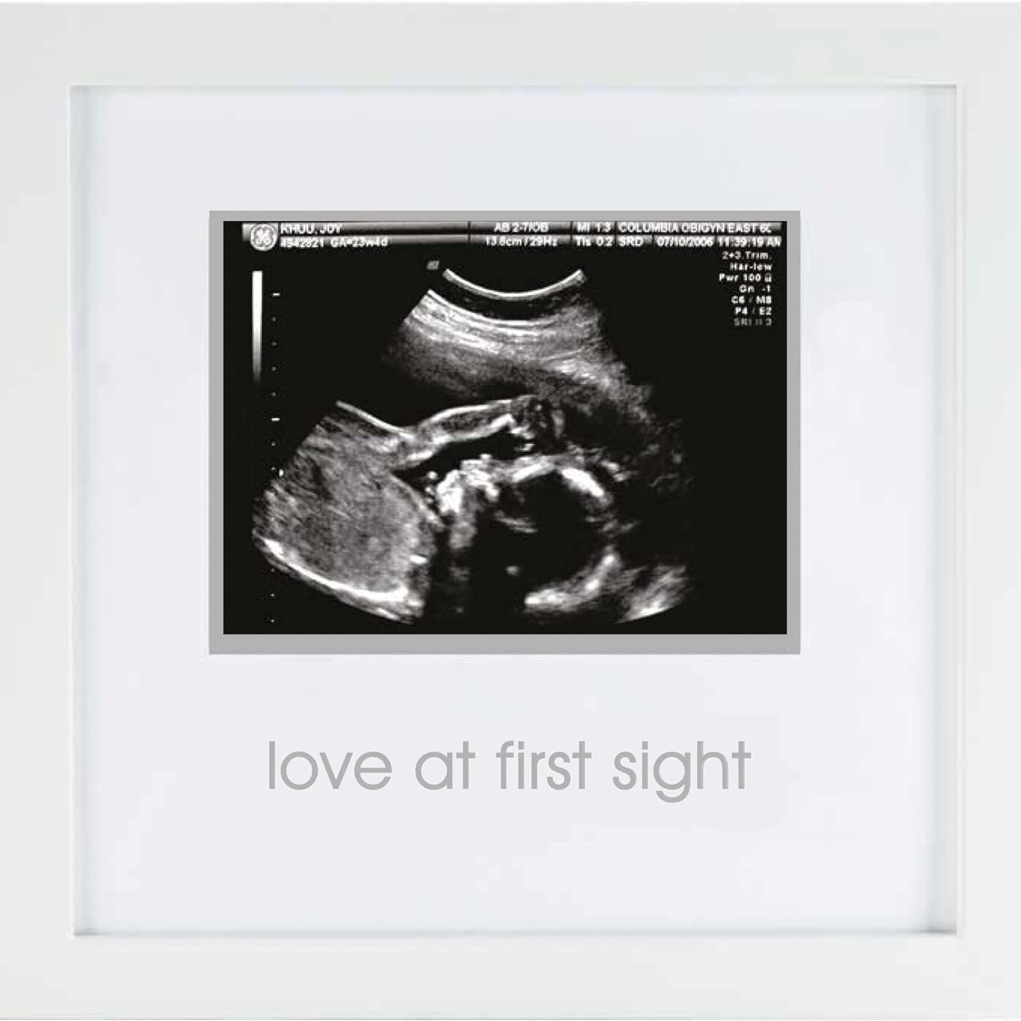 Exportación a Europa y América tablero de densidad marco de fotos B-ultrasonido foto madre y bebé producto recuerdo regalo marco de fotos