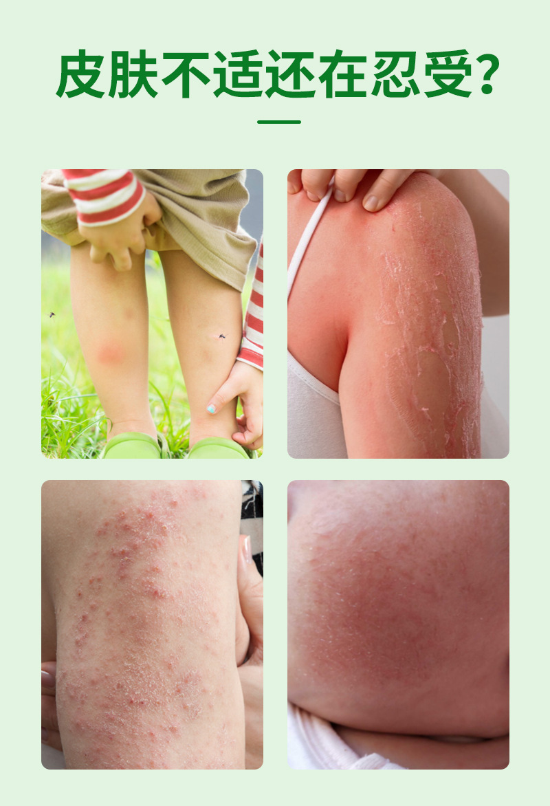 Wet Itch Clearing Herbal Ointment 20g External Topical Balm for Wrist and Skin Care quality and texture