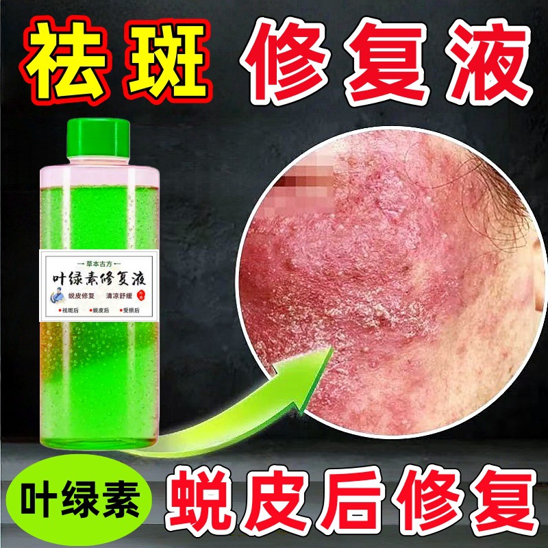 表皮修复液增厚角质层祛斑尴尬期斑后激素脸脸干脸红脸痒修复退红