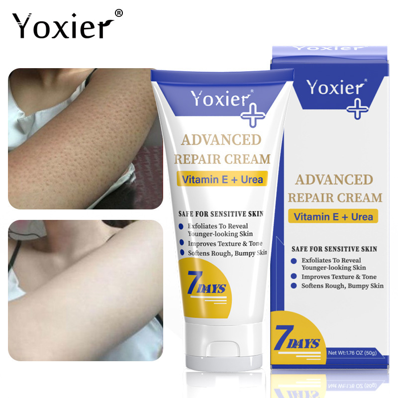 Yoxier advancedrepair cream 50gクロスボーダー|undefined