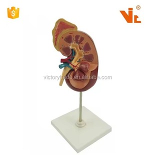 Production Human Kidney Structure Adrenal Gland Model Urology Medical Model 2 Times Human Kidney Anatomy Model