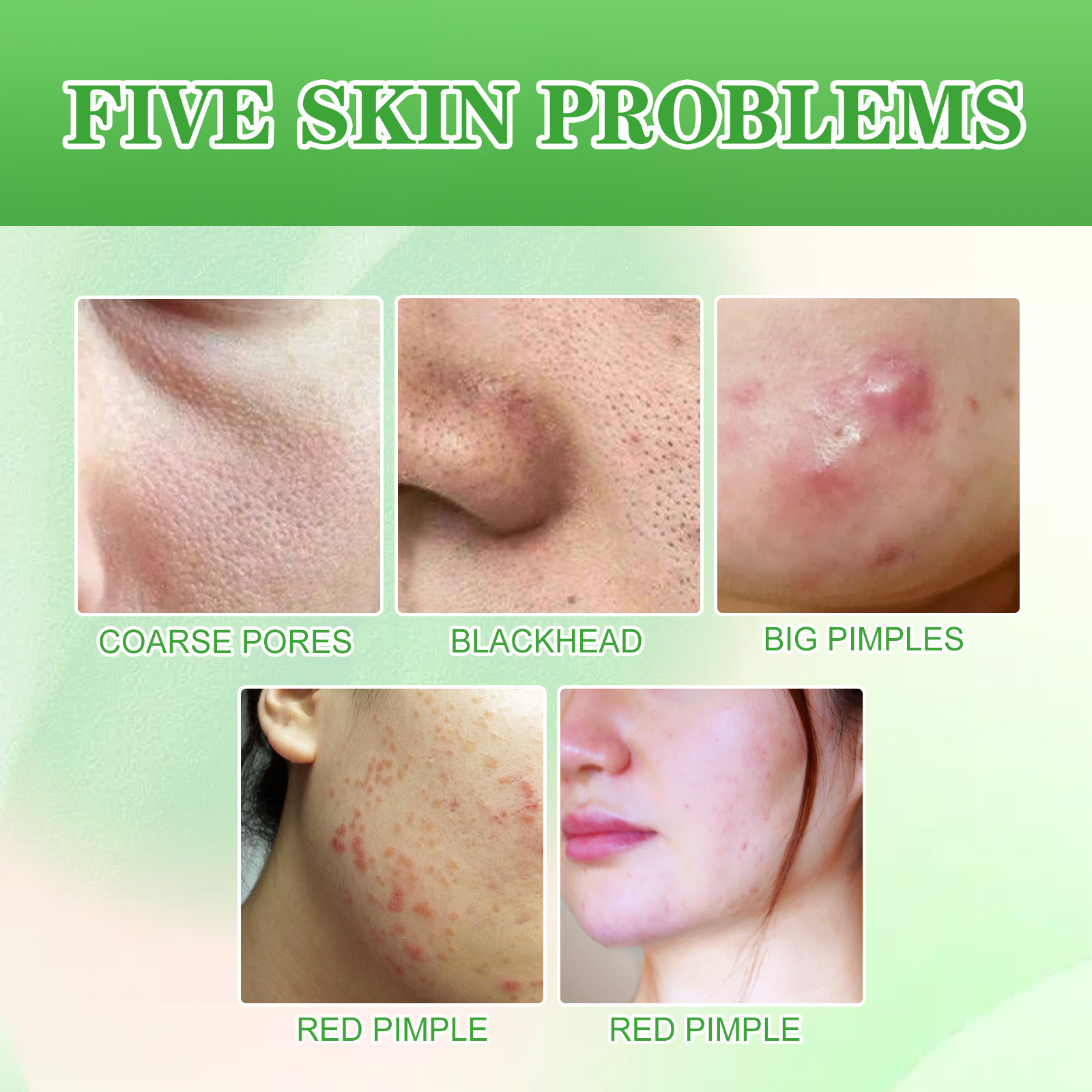 EELHOE Tampone detergente all'acido salicilico per punti neri e rimozione, controllo dell'olio a bocca chiusa, idratante, pulizia delicata,_voghion.com