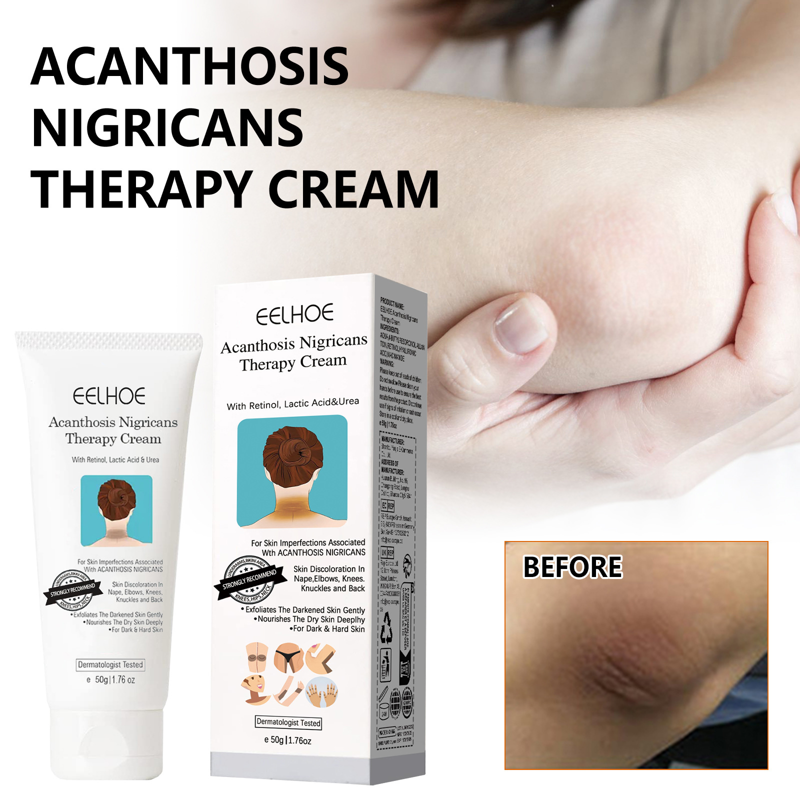 Eelhoe Black Skin Care Cream Moisturizes and Softens Arms and Knees, Refreshes and Comforts Skin, Body Care