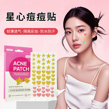 �羳��ɫ���ǐ��ĽM��ˮ�z�w�����NPE�����N�غ��ޏ͵�����ӡ���