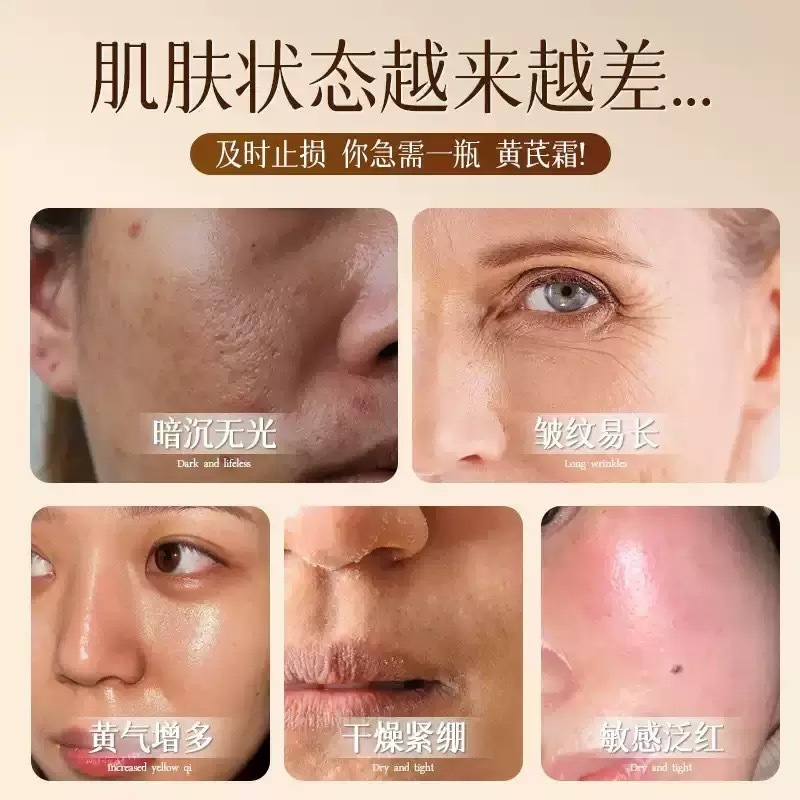 北京銅仁堂レンゲクリームは、くすんだ黄色の肌を改善し、潤いを与え、肌の色合いを明るくします。女性用の本物のクリームです。|undefined