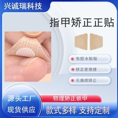 現物の爪の爪の甲には、爪の矯正器の足の爪の爪の長い肉の中に接着剤を入れないでください。