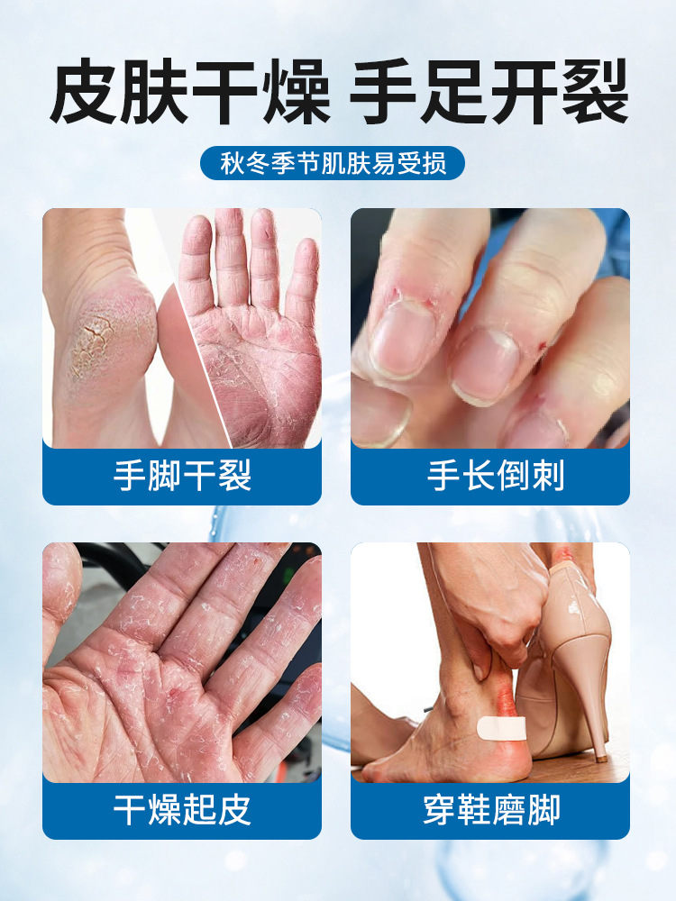 Vaselina agrietamiento seco dedo talón aloe pegamento anti-agrietamiento pegamento adhesivo especial para manos y pies talón pegamento anti-agrietamiento