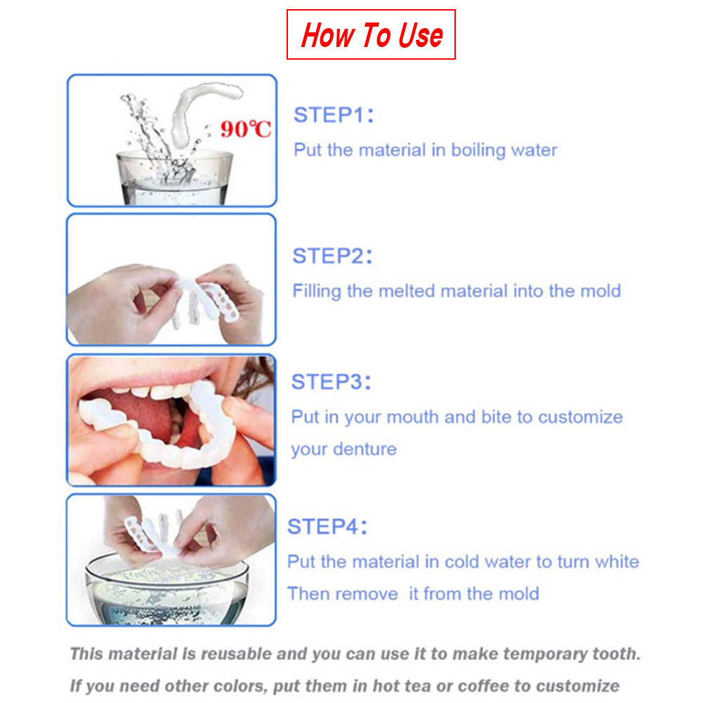 Snap-On Smile Image 3