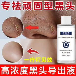 ��s���^����Һ�غ�ȥ���^����Ժ�۴��]���坍���^�o��ë���տsҺ