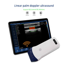 linear wireless probe type color doppler ultrasound scanner