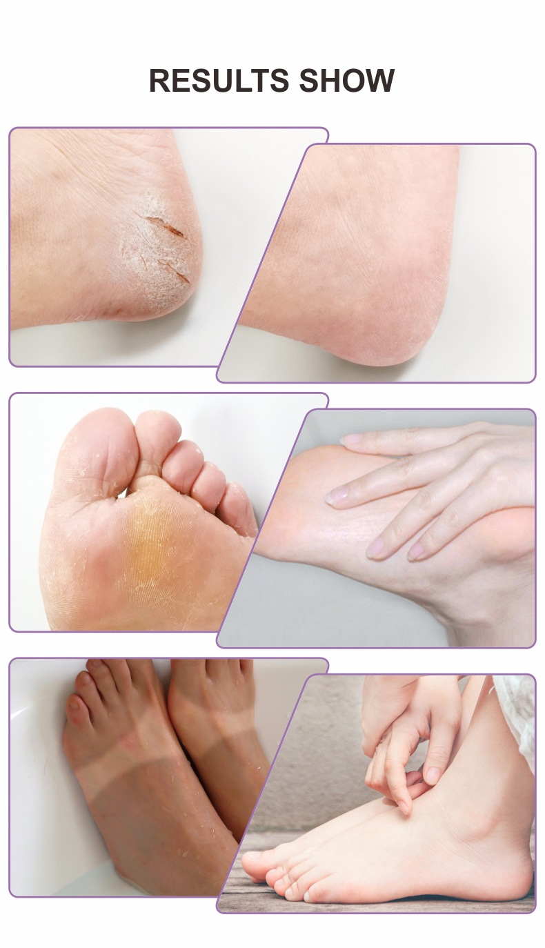 Portsley foot mask薰衣草去角质足膜 详情0