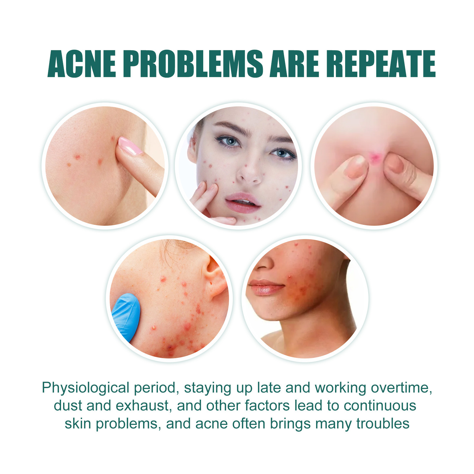 Star shaped patch for lightening spots, marks, cleaning, closing, covering, and repairing acne patches_voghion.com