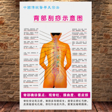 背部刮痧示意图养生馆美容人体穴位挂图中医宣传海报脊背确诊贴画