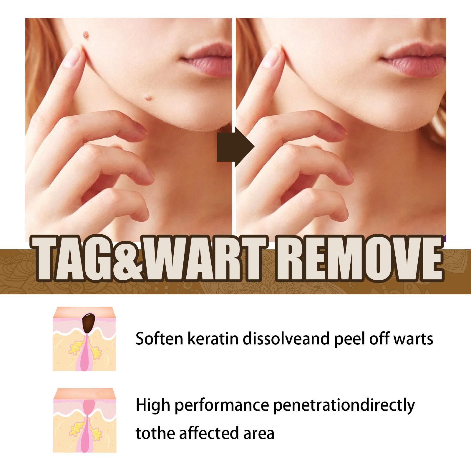 EELHOE wart oil repair for warts, black facial convex nevi, anti mole scar free nevus cocoon, clear and smooth skin_voghion.com