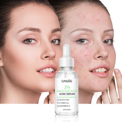 国境を越えた人気の抗ニキビエッセンス 30mAnti-acne セルム アクネ アクネ クローズド アクネ エッセンス