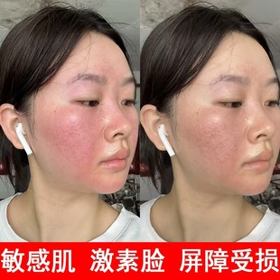 ���м��ޏ;��AҺ����Ęȥ�t�[�g���沿���ƼtѪ�z�eѩ���澏ԭҺ