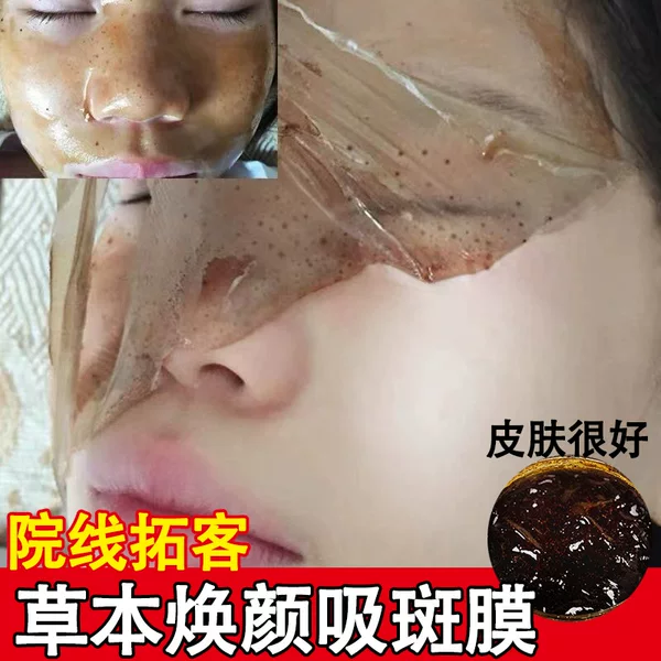 Beauty Salon Facial Cleansing Mask, Whitening and Freckle Removal Mask, Remove Chloasma and Age Spots in Five Days, Absorbent Spot Mask, Peel-Off Mask