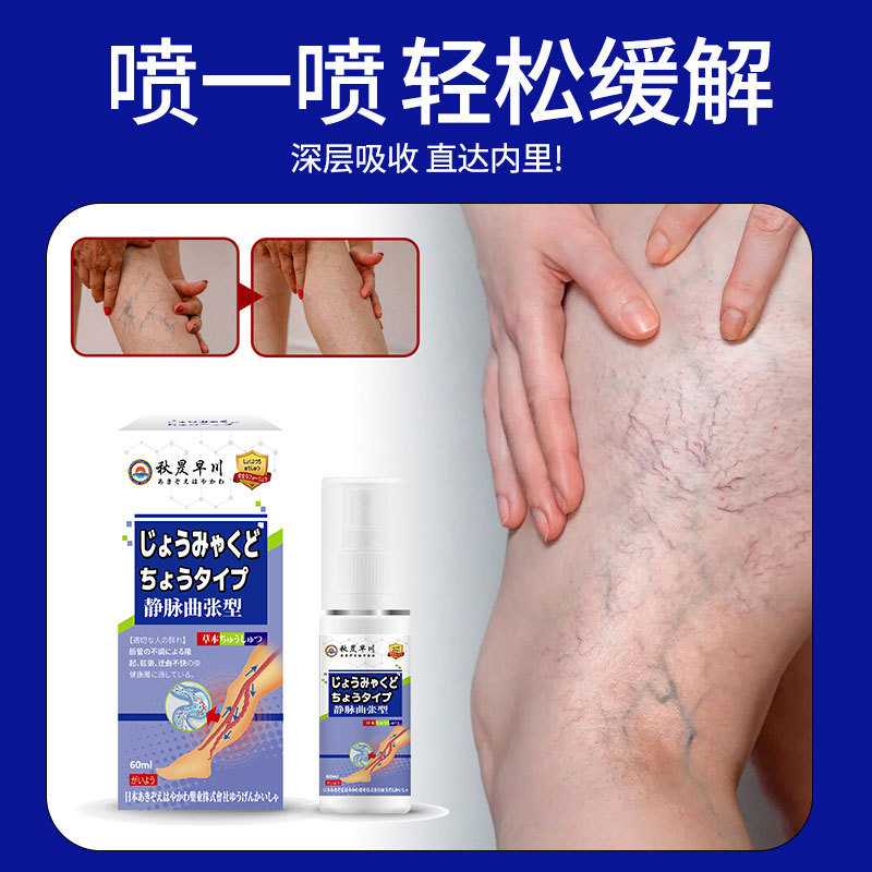 静脉弯曲型护理喷雾腿部久站不适小腿酸胀血管突出弯曲腿部护理液|undefined