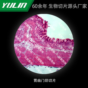 Gastric Helicot Slicing University Medical School Tissue Disease Marble Wax Slide Specimen Microscope