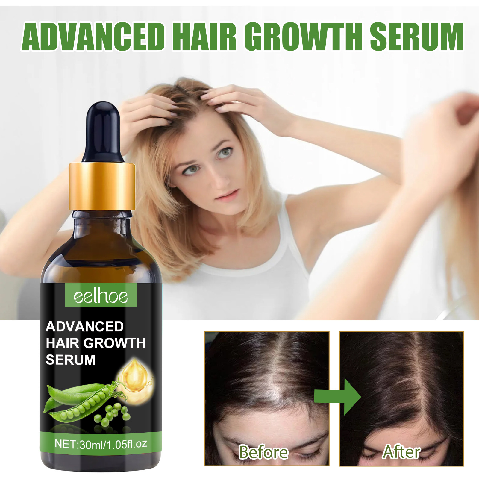 EELHOE Hair Essence Spendet Feuchtigkeit für die Haarwurzeln, pflegt die Kopfhaut, sorgt für kräftiges Haar, beugt Haarausfall vor und verdickt das Haar_voghion.com