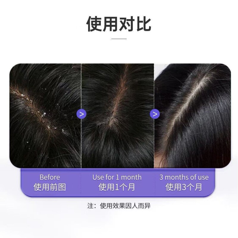 新版澳洲SHEVEU赛逸洗发水止痒硫化硒去头皮屑洗发膏控油去油蓬松|undefined