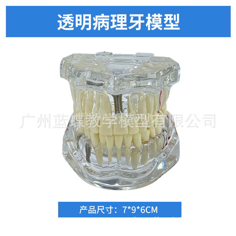 ���ƿ�ǻ�ı�ȣ�ݷֽ�ģ�� ����������ʾȣ�ݷ�չ���� ҽ����ͨ